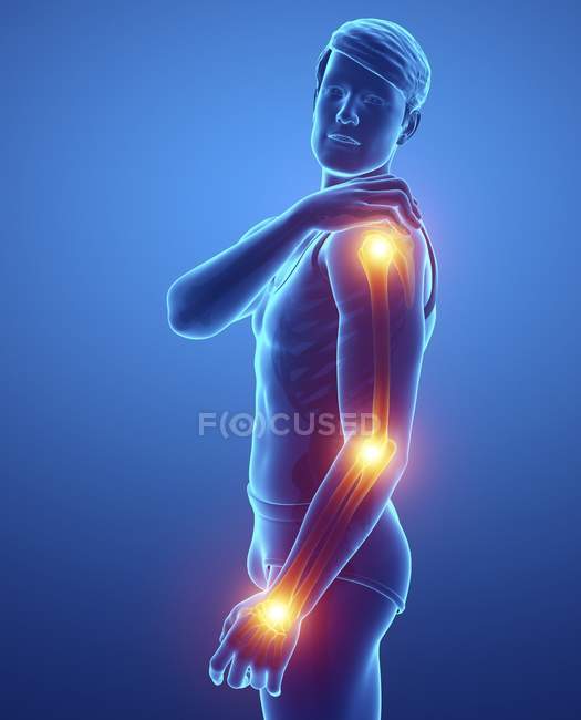 Männliche Silhouette mit Armschmerzen, digitale Illustration. — Stockfoto