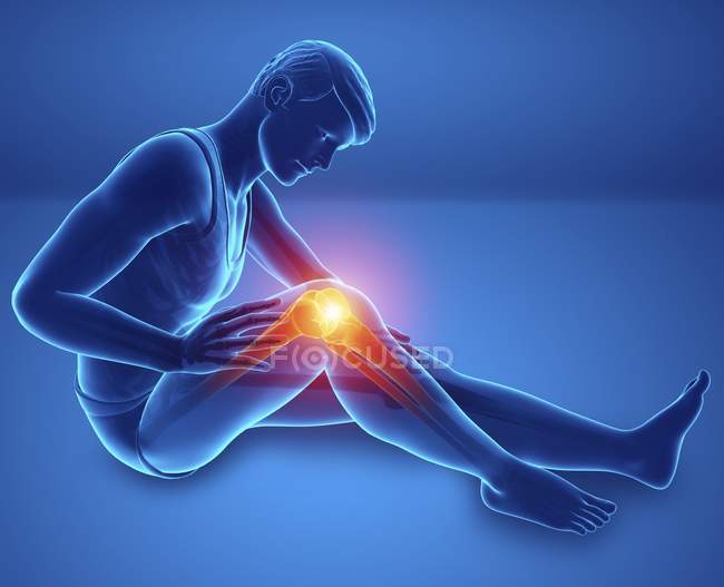 Sitting male silhouette with knee pain, digital illustration. — Stock Photo