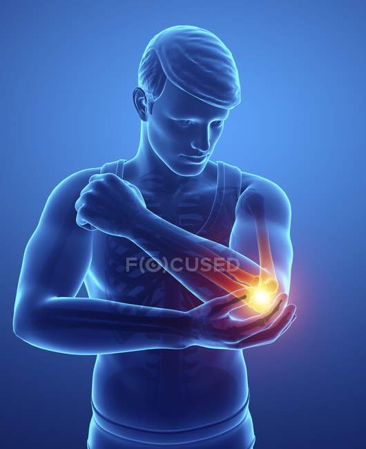Male silhouette with elbow pain, digital illustration. — Stock Photo