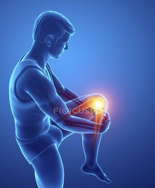 Male silhouette with knee pain, digital illustration. — Stock Photo