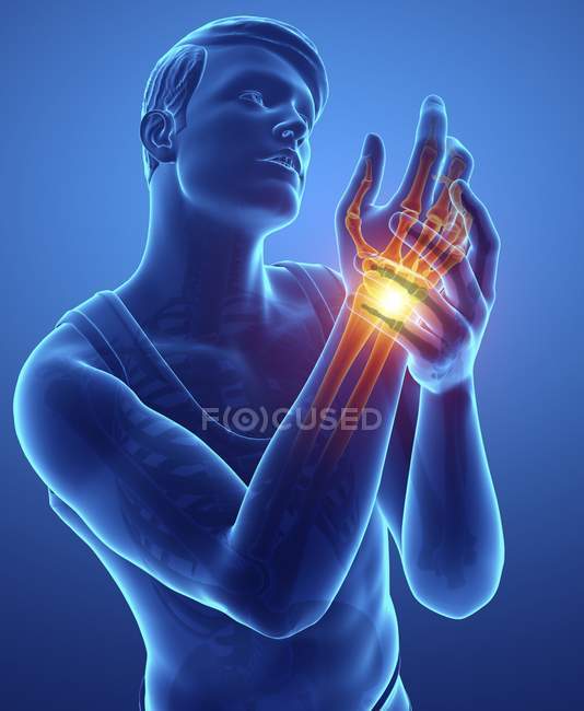 Silhouette maschile con dolore al polso, illustrazione digitale . — Foto stock