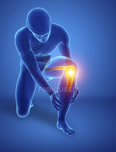 Silhueta masculina de flexão com dor no joelho, ilustração digital . — Fotografia de Stock