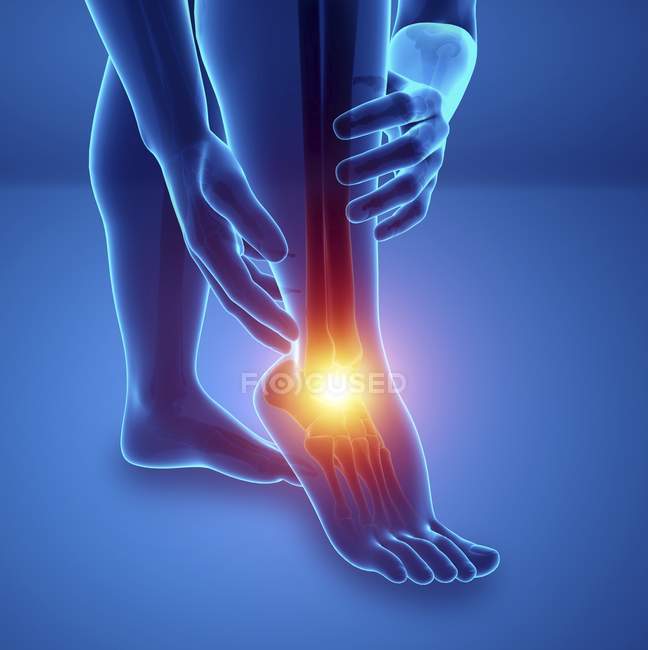 Силуэт мужских ног с болью в ногах, цифровая иллюстрация . — стоковое фото