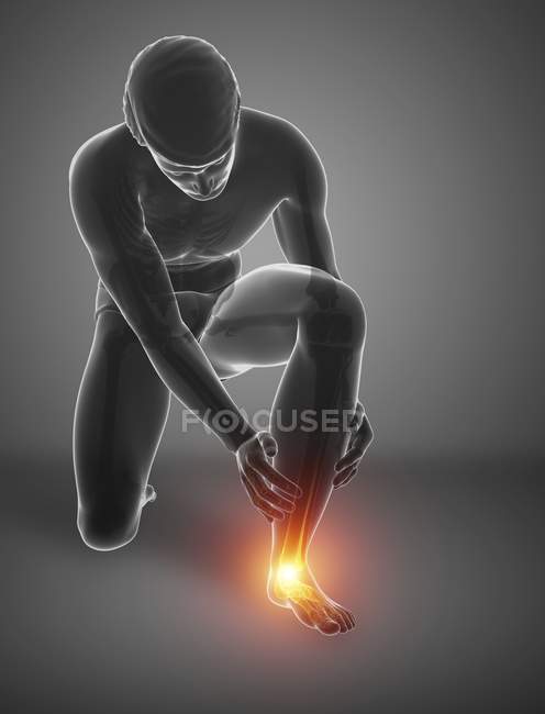 Bending male silhouette with foot pain, digital illustration. — Stock Photo