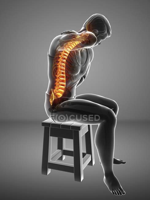 Сидящий на стуле мужской силуэт с болью в спине, цифровая иллюстрация
. — стоковое фото