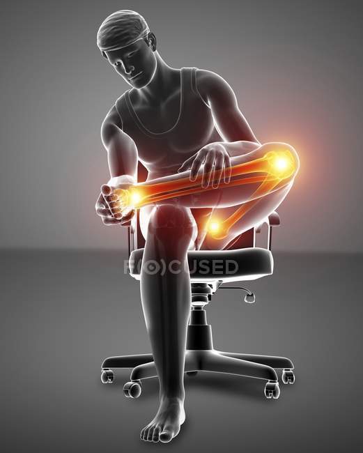 Seduto in sedia silhouette maschile con dolore al ginocchio, illustrazione digitale . — Foto stock