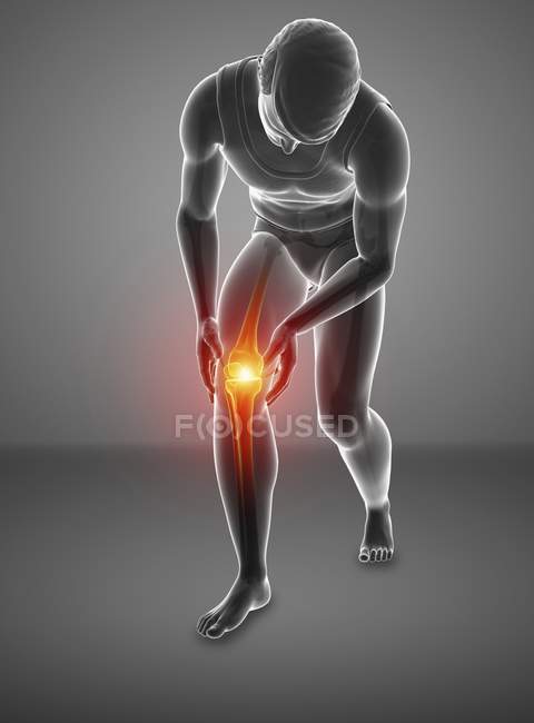 Bending male silhouette with knee pain, digital illustration. — Stock Photo