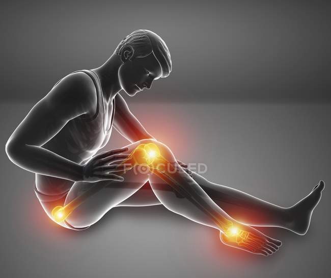 Silueta masculina sentada con dolor de rodilla, ilustración digital . - foto de stock