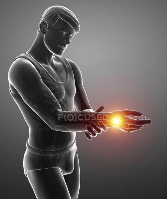 Silhouette masculine avec douleur au poignet, illustration numérique . — Photo de stock