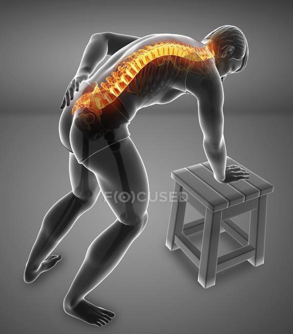 Bending male silhouette with back pain, digital illustration. — Stock Photo