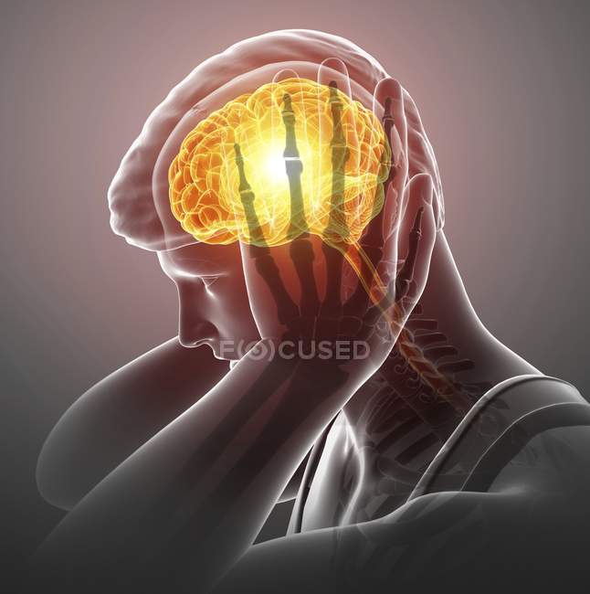 Male silhouette with headache, digital illustration. — Stock Photo