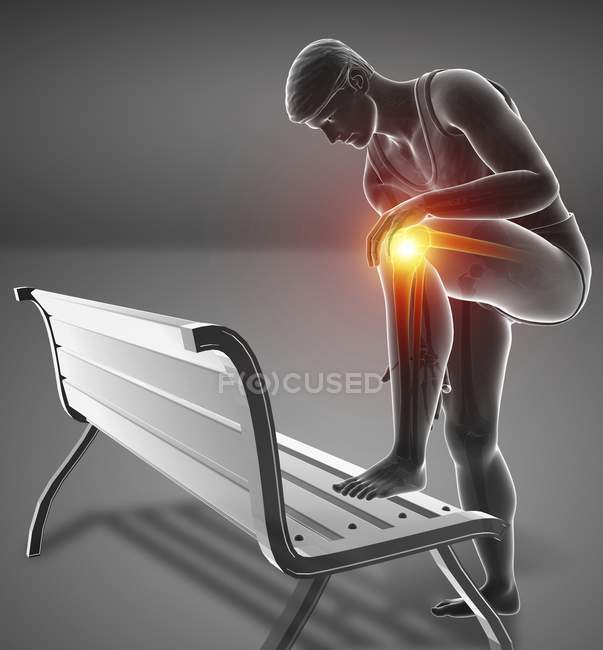 Doblado en el banco silueta masculina con dolor de rodilla, ilustración digital . - foto de stock