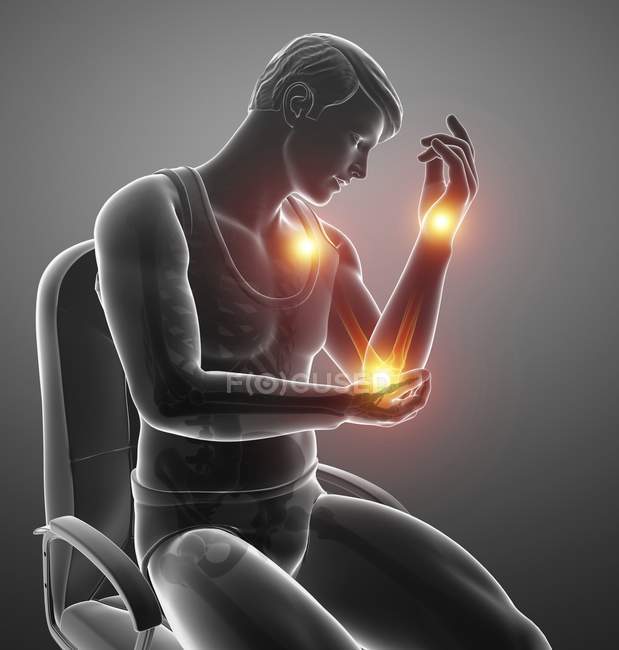 Sentado en silla silueta masculina con dolor en el brazo, ilustración digital . - foto de stock