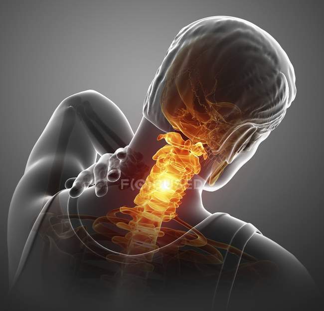 Мужской силуэт с болью в шее, цифровая иллюстрация
. — стоковое фото
