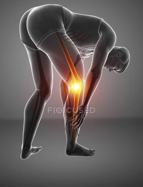 Curvatura sagoma maschile con dolore al ginocchio, illustrazione digitale . — Foto stock