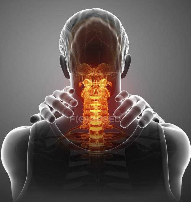 Male silhouette with neck pain, digital illustration. — Stock Photo