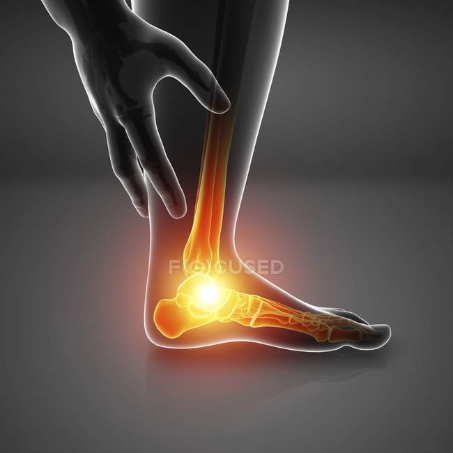 Männliche Fußsilhouette mit Fußschmerzen, digitale Illustration. — Stockfoto
