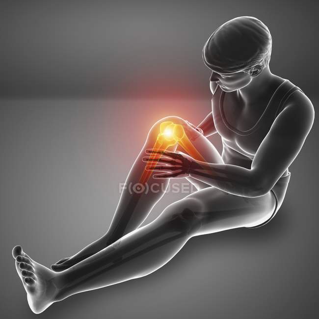 Сидящий мужской силуэт с болью в колене, цифровая иллюстрация
. — стоковое фото