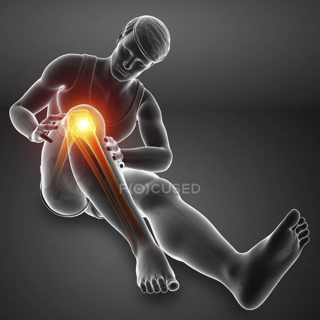 Sitting male silhouette with knee pain, digital illustration. — Stock Photo