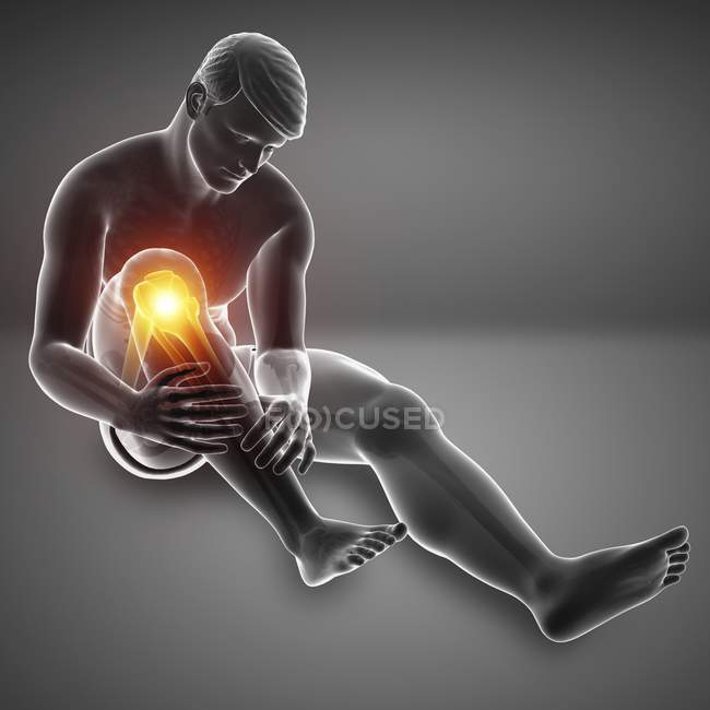 Sitzende männliche Silhouette mit Knieschmerzen, digitale Illustration. — Stockfoto