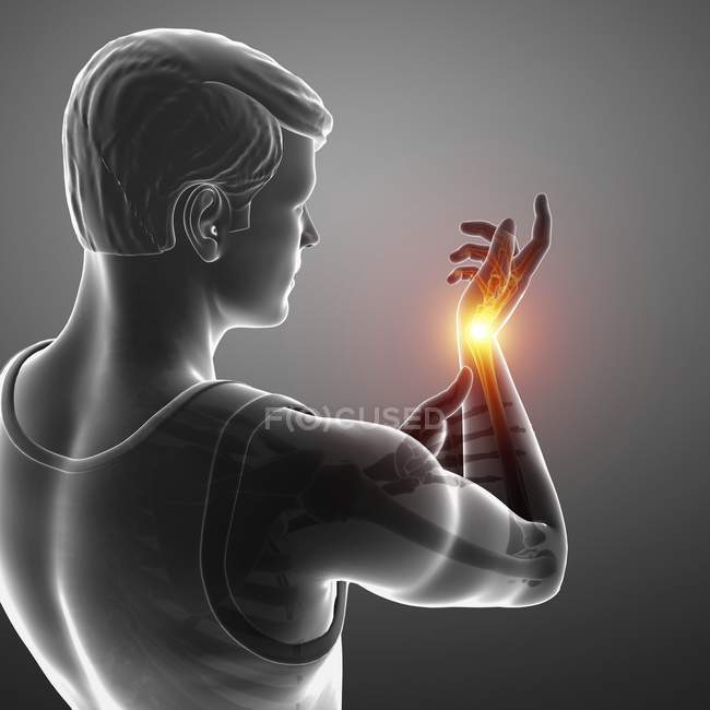 Male silhouette with wrist pain, digital illustration. — Stock Photo