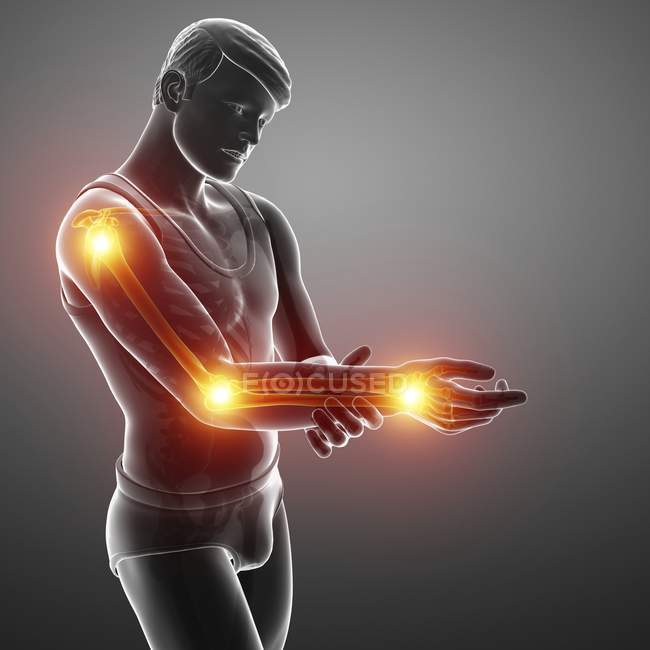 Silueta masculina con dolor en el brazo, ilustración digital . - foto de stock
