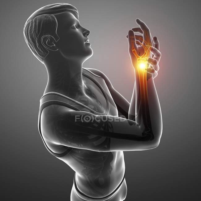 Мужской силуэт с болью в запястье, цифровая иллюстрация
. — стоковое фото