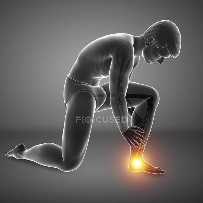 Bending male silhouette with foot pain, digital illustration. — Stock Photo