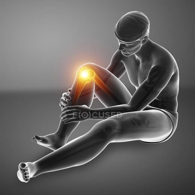 Silhouette masculine assise avec douleur au genou, illustration numérique . — Photo de stock
