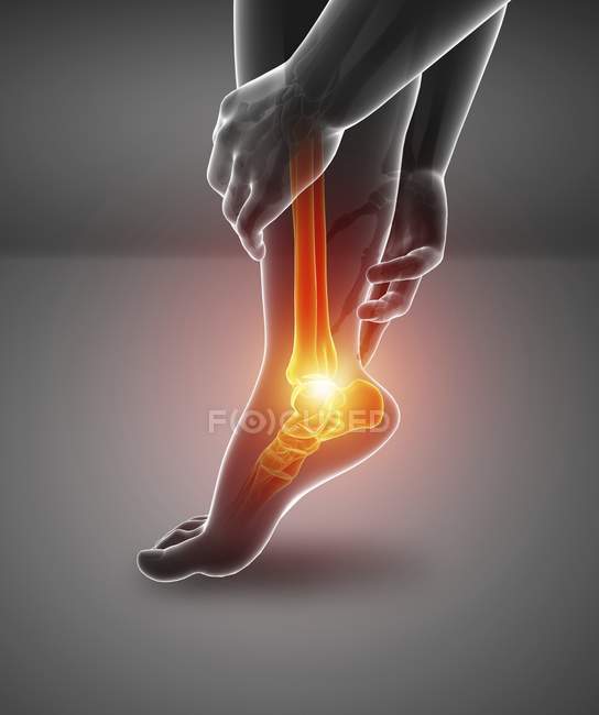 Silhouette piede maschile con dolore al piede, illustrazione digitale . — Foto stock