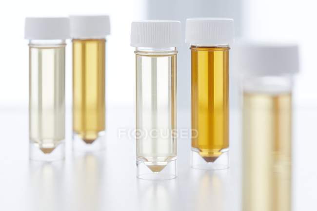 Tubos de ensaio com amostras de urina para análise . — Fotografia de Stock