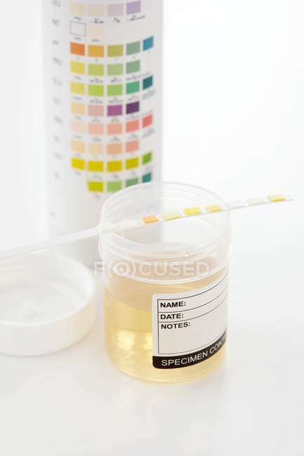 Urine sample for analysis and test strip with chart, studio shot. — Stock Photo