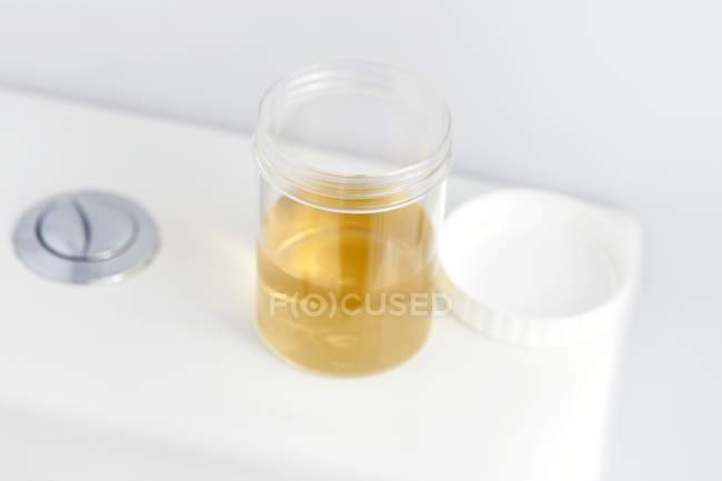 Récipient d'échantillon d'urine sur les toilettes dans la salle de bain, plan studio . — Photo de stock