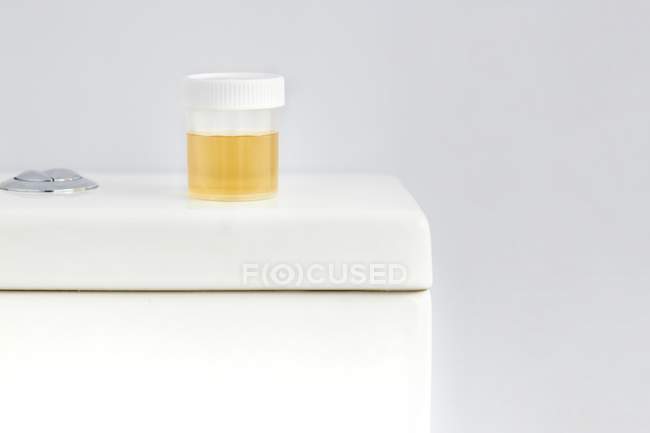 Recipiente de muestra de orina en el inodoro en el baño, toma de estudio . - foto de stock