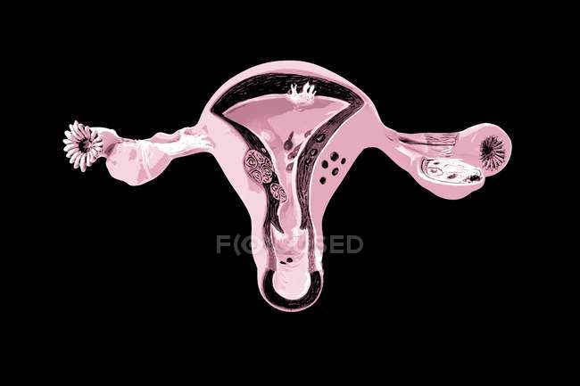 Модель женской репродуктивной системы . — стоковое фото