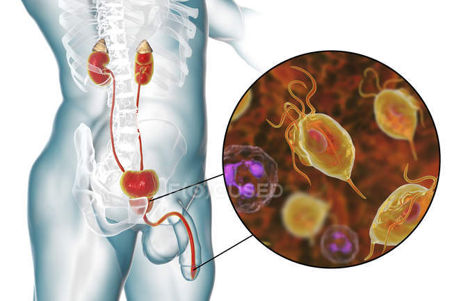 Ilustración del sistema urinario masculino y parásito Trichomonas vaginalis causante de tricomoniasis
. - foto de stock