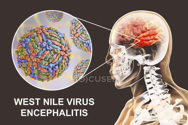 Illustration numérique conceptuelle de l'encéphalite causée par le virus du Nil occidental
. — Photo de stock