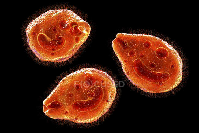 Ilustração digital do protozoário ciliado Balantidium coli parasitas intestinais causando úlcera no trato intestinal . — Fotografia de Stock