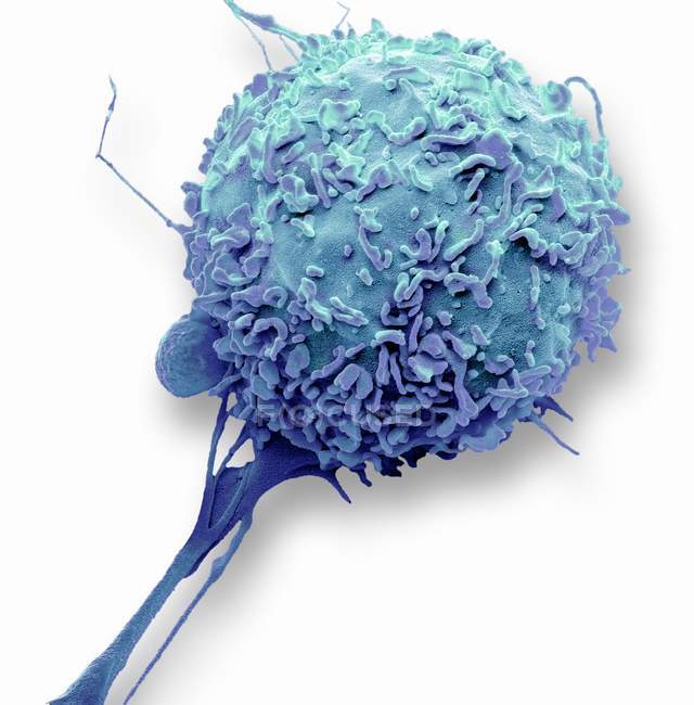 Micrógrafo electrónico de barrido coloreado de glóbulos blancos macrófagos
. - foto de stock