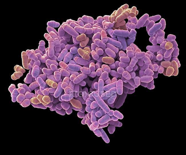 Кольоровий сканування електронного мікрографа ділення дріжджових клітин Schxosaccharomyces pombe . — стокове фото