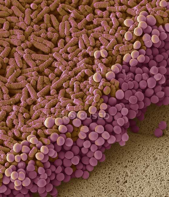 Micrografía electrónica de barrido de bacterias cultivadas a partir de muestras de heces humanas
. - foto de stock
