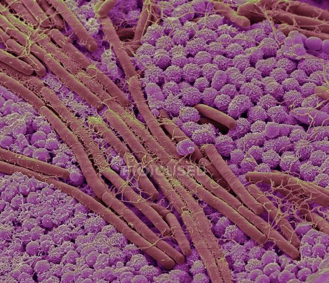 Micrographie électronique à balayage coloré des bactéries à la surface de la langue humaine . — Photo de stock