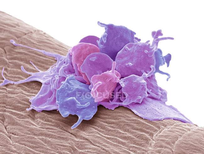 Micrographie électronique à balayage coloré des plaquettes activées fixées à la gaze chirurgicale . — Photo de stock