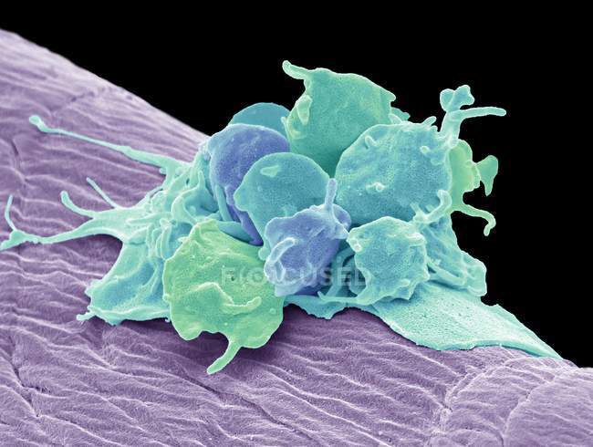 Цветной сканирующий электронный микрограф активированных тромбоцитов, прикреплённых к хирургической марле
. — стоковое фото