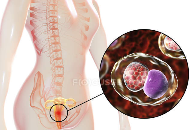 Illustration numérique du système reproducteur féminin et de la bactérie Chlamydia trachomatis à l'origine de l'infection à Chlamydia . — Photo de stock