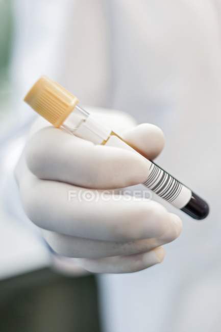 Laboratory assistant holding test tube, close-up. — Stock Photo