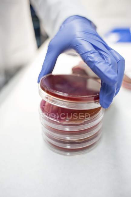 Mano guantata di assistente di laboratorio che sorveglia la crescita in capsule di Petri, primo piano . — Foto stock