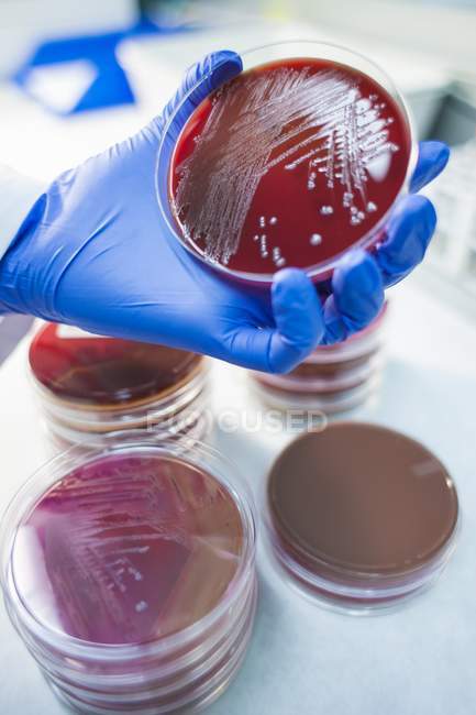 Guante de mano del asistente de laboratorio examinando el crecimiento en placa de Petri, primer plano
. - foto de stock
