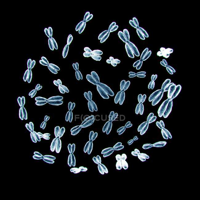 Satz von 46 menschlichen Chromosomen auf schwarzem Hintergrund. — Stockfoto