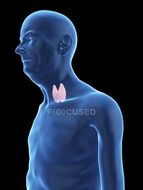 Illustration de la silhouette d'un homme âgé avec glande thyroïde visible . — Photo de stock